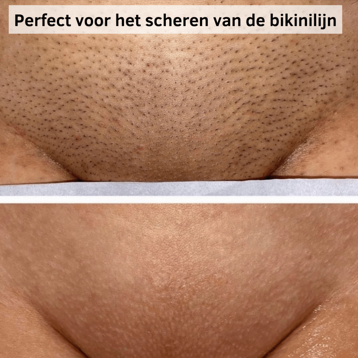 Gladde Huid Scheermes - Belloro Care