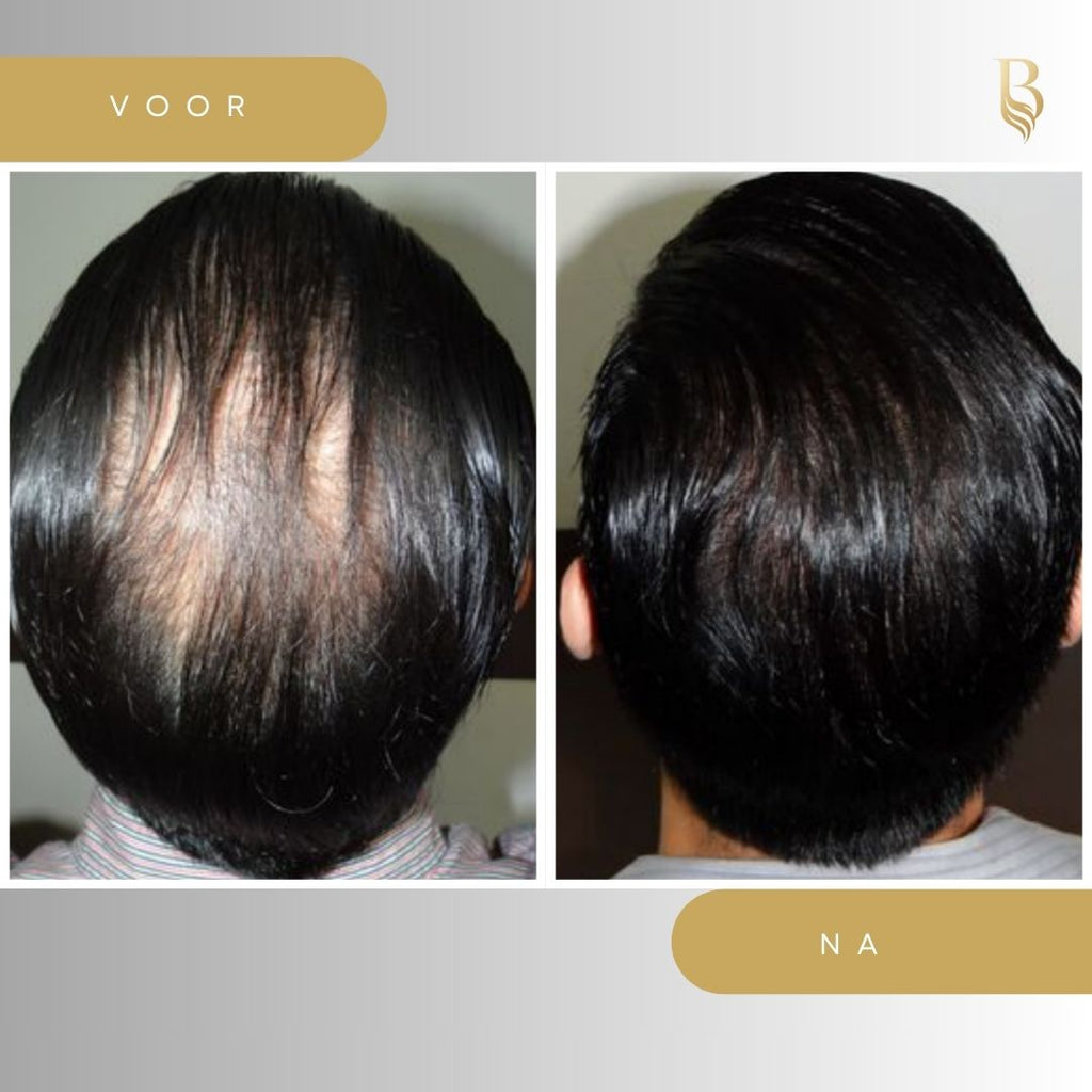 Haar serum 30ml - Belloro Care