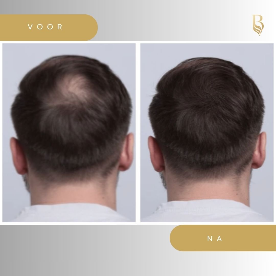 Haar serum 30ml - Belloro Care