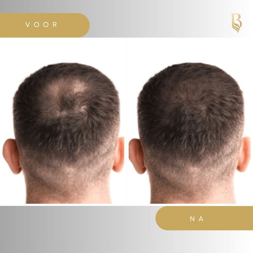 Haar serum 30ml - Belloro Care