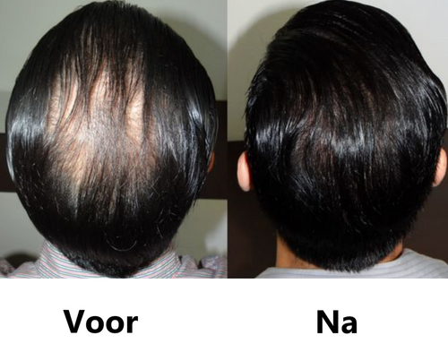 Haar serum 30ml