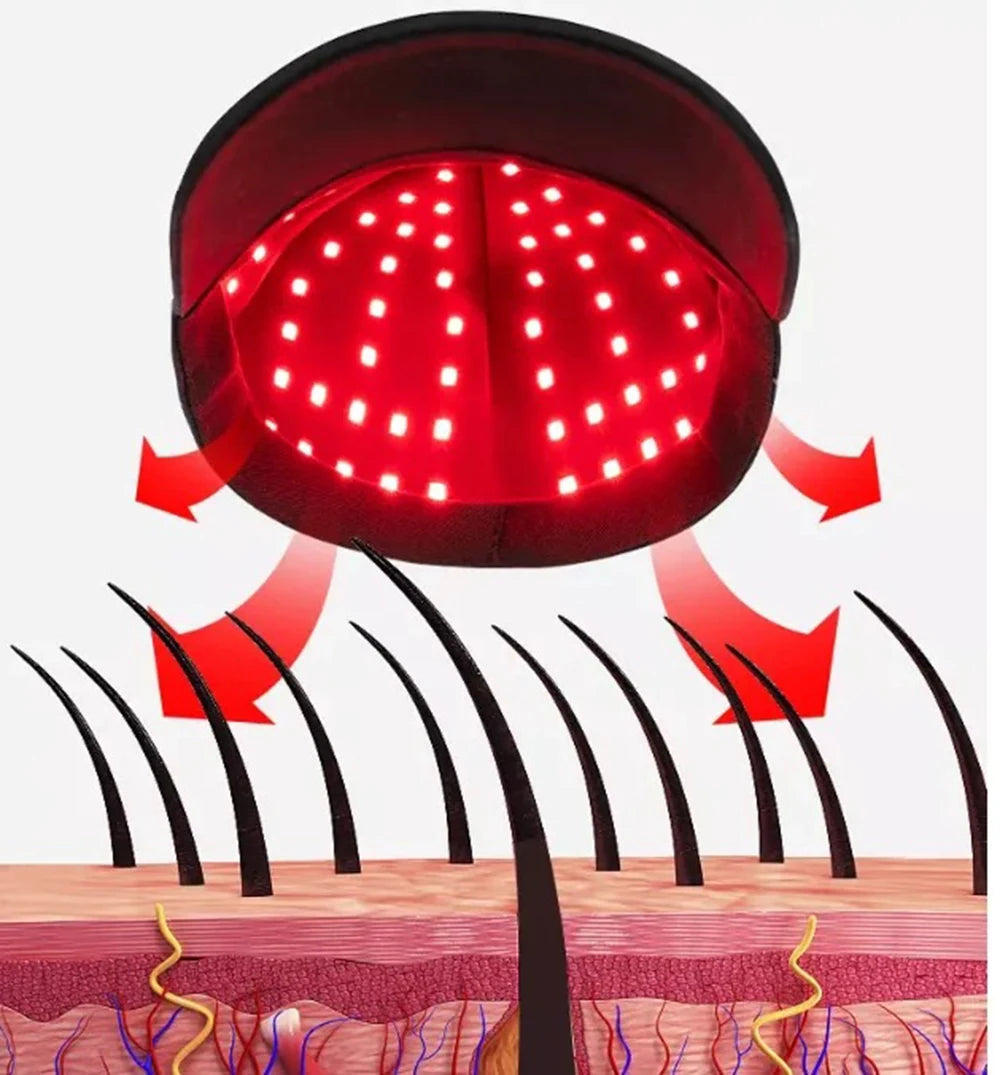 Lichttherapie Haar Groeimuts